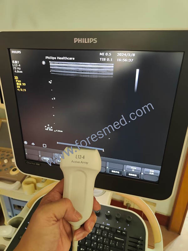 PHILIPS ClearVue 350 Ultrasound Machine