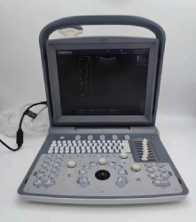 CHISON ECO 1 Portable Ultrasound Machine