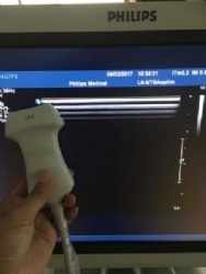 PHLIPS L9-3 Ultrasound probe after repaired performance