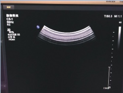 PHILIPS C5-1 Ultrasound probe after repaired performance